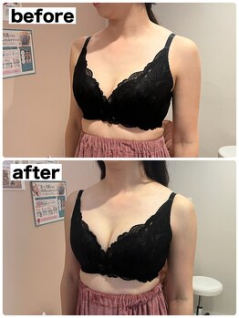 マイントゥー(mine too)/