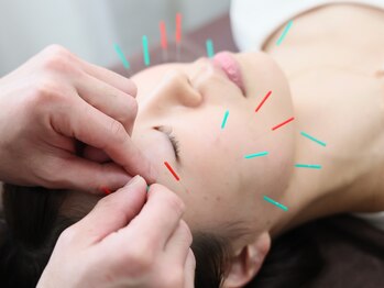 ふらみんご鍼灸整骨院/ターンオーバーを促進させます◎