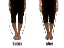 【美容整体】姿勢改善に大切な足の形！O脚・X脚を整えて美脚を作る！！¥15200→13200