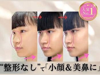 ラプリ 札幌ル・トロワ店/隆鼻＋輪郭矯正40分 30回