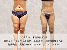 エクストリミティ 国立店(EXTREMITY)/お客様の変化