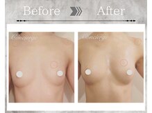 フェリス(Feliz)/【バストアップ/育乳/安城】