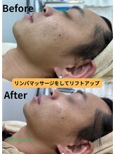 ルポ(Repos)/ブライダルシェービング