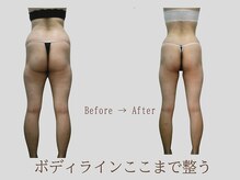 プレリー 自由が丘店/マシン/筋膜リリース