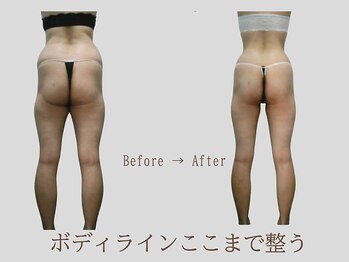 プレリー 自由が丘店/マシン/筋膜リリース