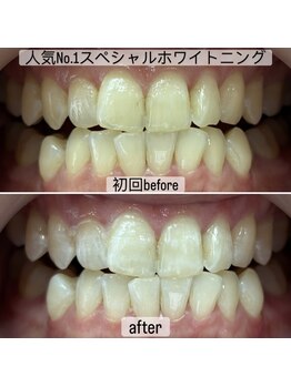 ヤット 森ノ宮(yatto.)/30代女性