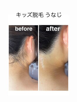 アオドットアール(Ao.r)/学校で髪の毛結ぶお子様へ