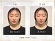 シルク(SILK)の写真/【小顔矯正・顔の歪み矯正専門サロン】顔が歪むことによって、エラ張り・顔のたるみ・左右差がおこる！？