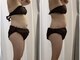 ポルトボーテ(Porte Beaute)の写真/【韓国進化系インディバ】全身リンパ流し！脂肪を分解＆燃焼で老廃物の排出を促進し痩せやすい身体作りを◎