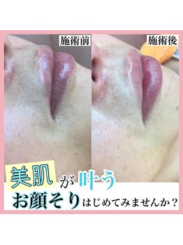 M/レディースシェービング専門店