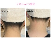 サロン ド モモ(salon de momo)/うなじwax脱毛