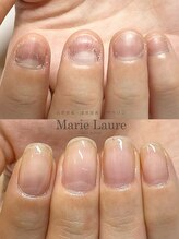 マリーロール 梅田店(Marie Laure)/自爪育成/深爪矯正/ネイルケア