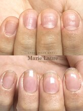 マリーロール 梅田店(Marie Laure)/自爪育成/深爪矯正/ネイルケア