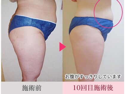 ビューティ ケア ルーム メロウ(Beauty Care Room Moelleux)の写真