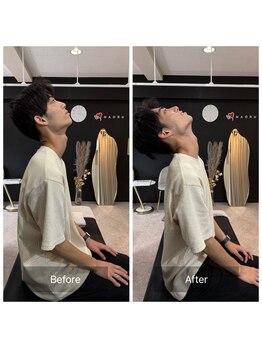 ナオル整体 広島福山院(NAORU整体)/肩こり/首こり→Before/After