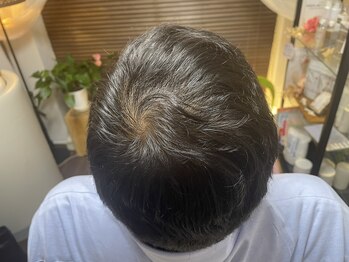 ココ 2号店(CoCo)/6/30ハーブ棘ケア/頭皮環境改善