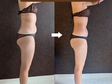 １カ月のビフォーアフター！ピラティスと温活で―２，７キロ