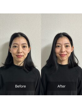 プラスアルファ(PLUSALPHA)/