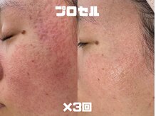 テセラ(Tethere)の雰囲気（モニター募集！通常よりお安くできます。詳細はブログへ）