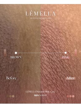 ミリノ(Salon MIRINO)/ルメラ♪陰部