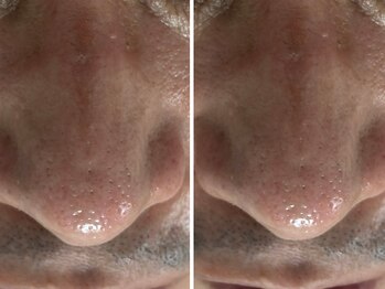 セレスティア(Cellestia)の写真/モテ男は肌管理必須!口コミ数が実績の証!ニキビケアやオイリー肌は勿論、敏感肌・毛穴汚れが気になる方も◎