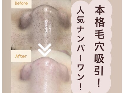 ルイスラグジュアリー(LOUIS LUXURY)の写真