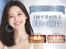 エヌエーホワイトニング 大和郡山店(NA ホワイトニング)