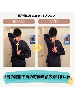 メディカル整体院/肩甲骨はがし☆ビフォーアフター