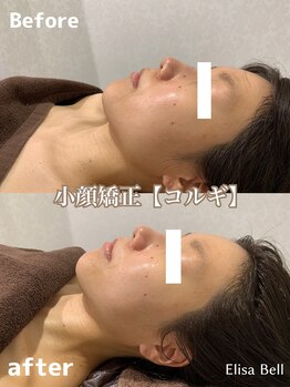 エリーザベル(Elisa Bell)/小顔矯正コルギ