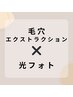 《既存のお客様専用》 毛穴ケア×光フォト