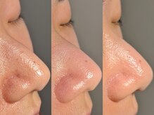 ルーナジェーナ(Luna llena)/