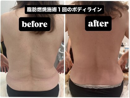 ブライトプラス 姫路店(Bright plus)の写真