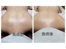 ルシアル(LUCIALL)/