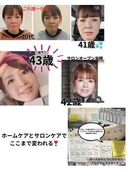 シェーングランツ(SchonGlanz)/私のお肌が証明★