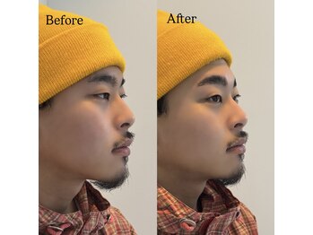 バレベッカ(Ballebecca)/HBL☆