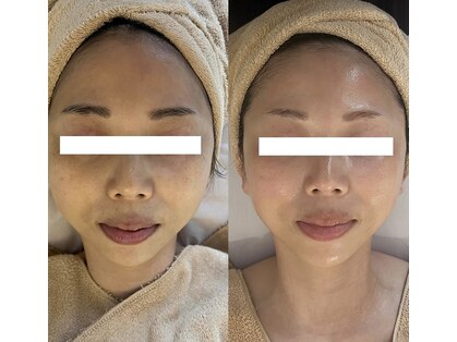 ボニータ(Bonita)の写真