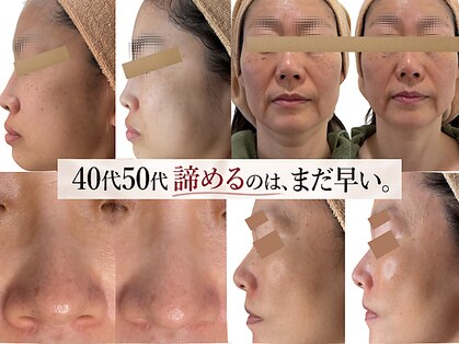 リボーン 柏(REBORN)の写真