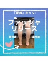 アロマフリー(AROMA FREE)/【美脚特化】ファッシャリリース