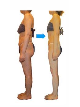 エステティック アントワネット/５６歳ビフォーアフター☆