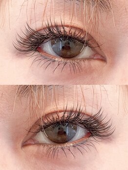 ベルグレン(Belleglen)/