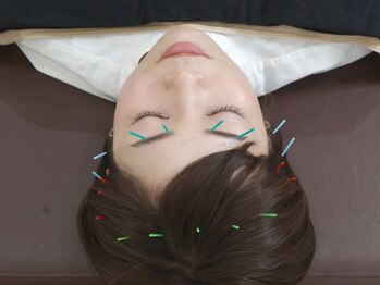 はり日和/【鍼×電気×整体】