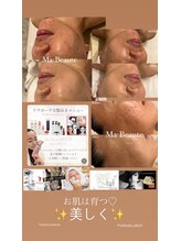 マボーテ 恵比寿(Ma-Beaute)/お肌悩みリアボーテ専門マボーテ
