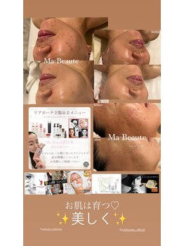 マボーテ 恵比寿(Ma-Beaute)/お肌悩みリアボーテ専門マボーテ