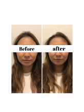 リモド(Rimodo509)/小顔矯正（ヘッドスパ