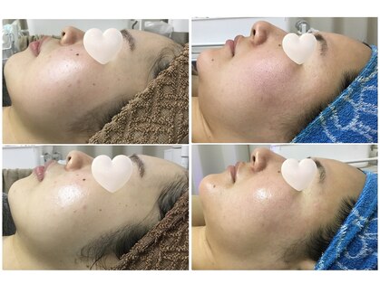ルヴィ 藤岡店(REVI)の写真