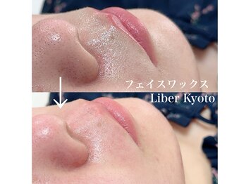 リベルキョウト 京都駅前店(Liber Kyoto)/フェイスワックス脱毛