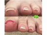 巻き爪矯正（フット専用ジェル）¥8800