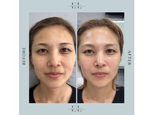 ホワイトラボ 姫路(White labo)の雰囲気(姫路初☆究極のエイジングケア【Exo Lift】で自信のあるお肌に☆)