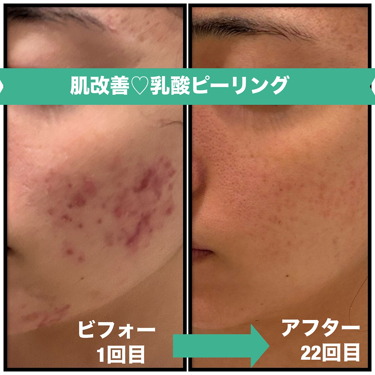 グリーンルーム(green room)｜ホットペッパービューティー