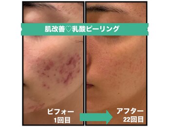 グリーンルーム(green room)